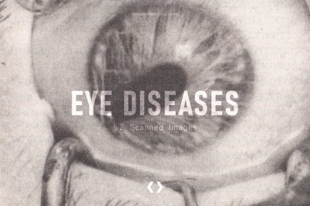 Eye Diseases — 60+ Scanned Images
